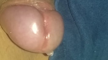 Papulas perladas glande