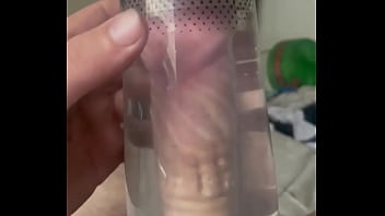 Deformacion del pene